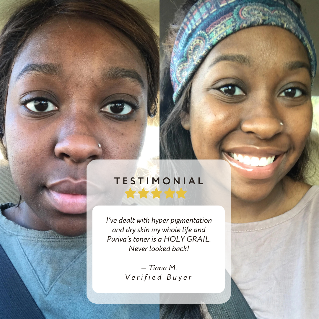 PURIVA™ 5X Vitamin C Brightening Face Toner