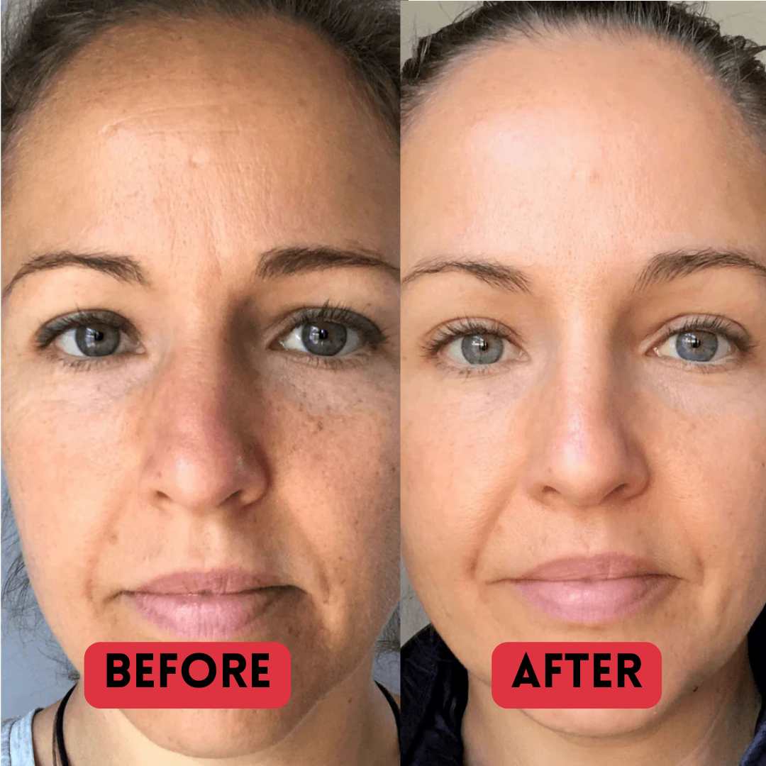 PURIVA™ Madeca Anti Aging Cream