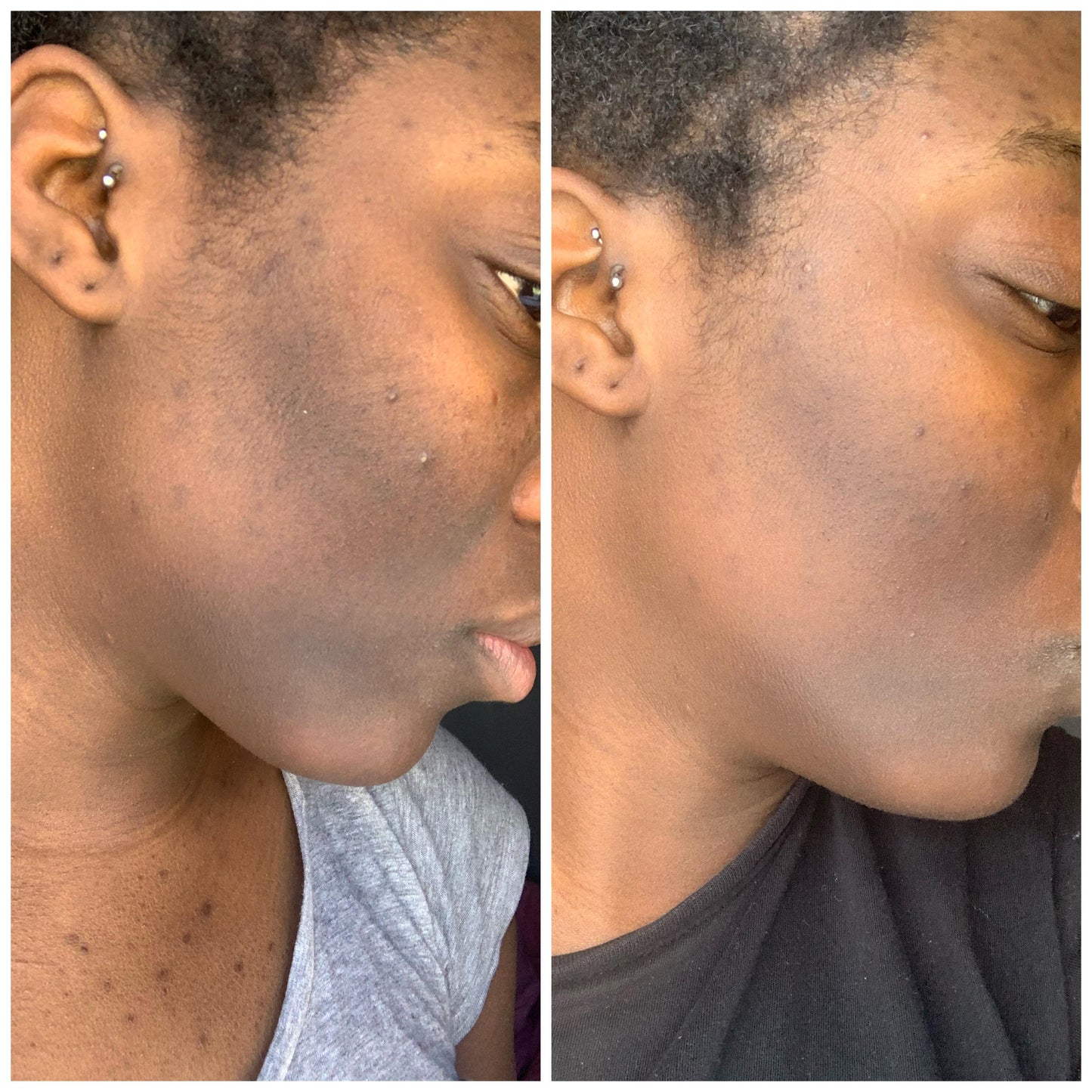 PURIVA™ 5X Vitamin C Brightening Face Toner