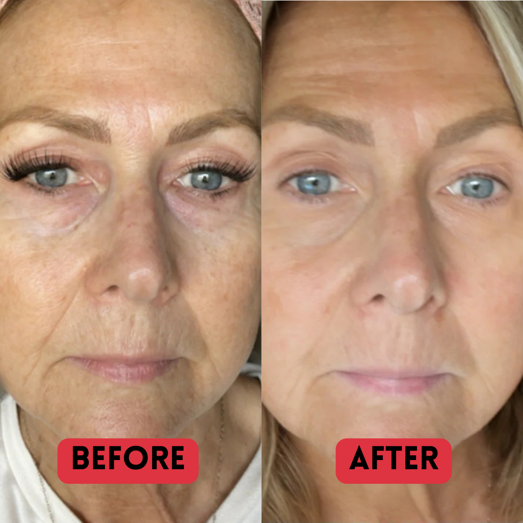 PURIVA™ Madeca Anti Aging Cream