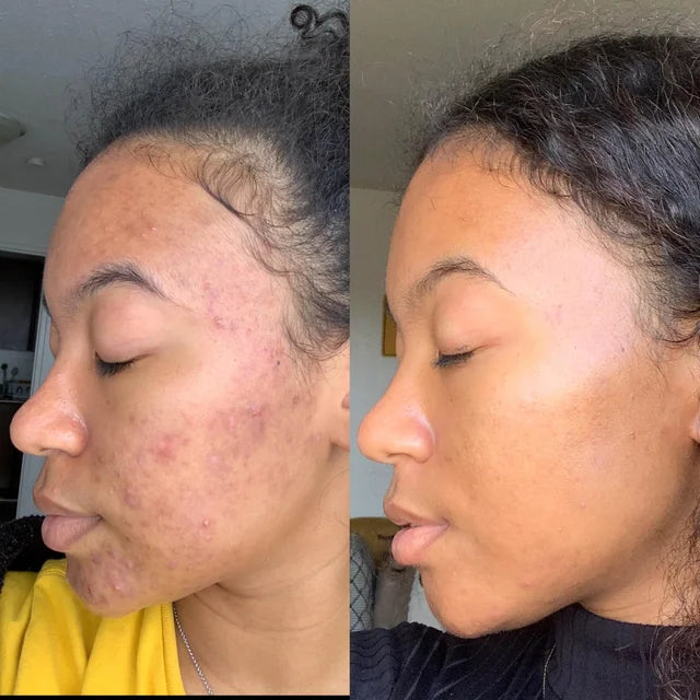 PURIVA™ 5X Vitamin C Brightening Face Toner